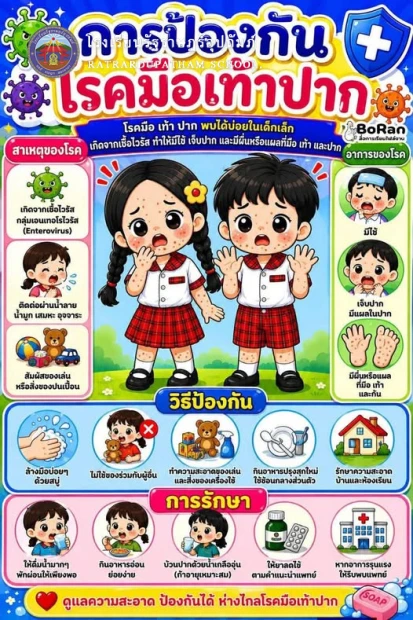 📢 แจ้งเตือนจากโรงเรียน: เฝ้าระวังโรคมือเท้าปาก 🦠